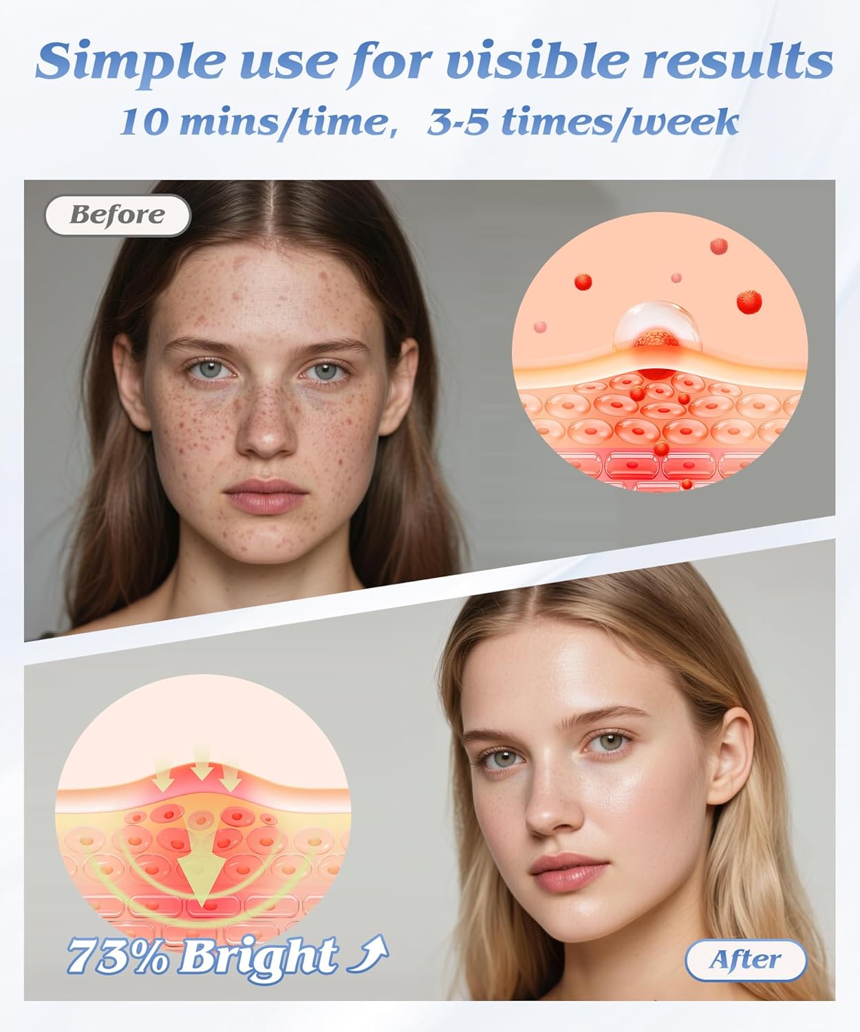 Red Light Therapy for Face, Light Therapy Mask for Firming, Wrinkles & Acne, Wireless Red & 850nm Infrared Light Silicone Mask, 7-Color LED Face Mask Portable for Use at Home & Travel, Green - Image 5