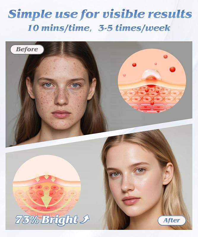 Red Light Therapy for Face, Light Therapy Mask for Firming, Wrinkles & Acne, Wireless Red & 850nm Infrared Light Silicone Mask, 7-Color LED Face Mask Portable for Use at Home & Travel, Green image 5