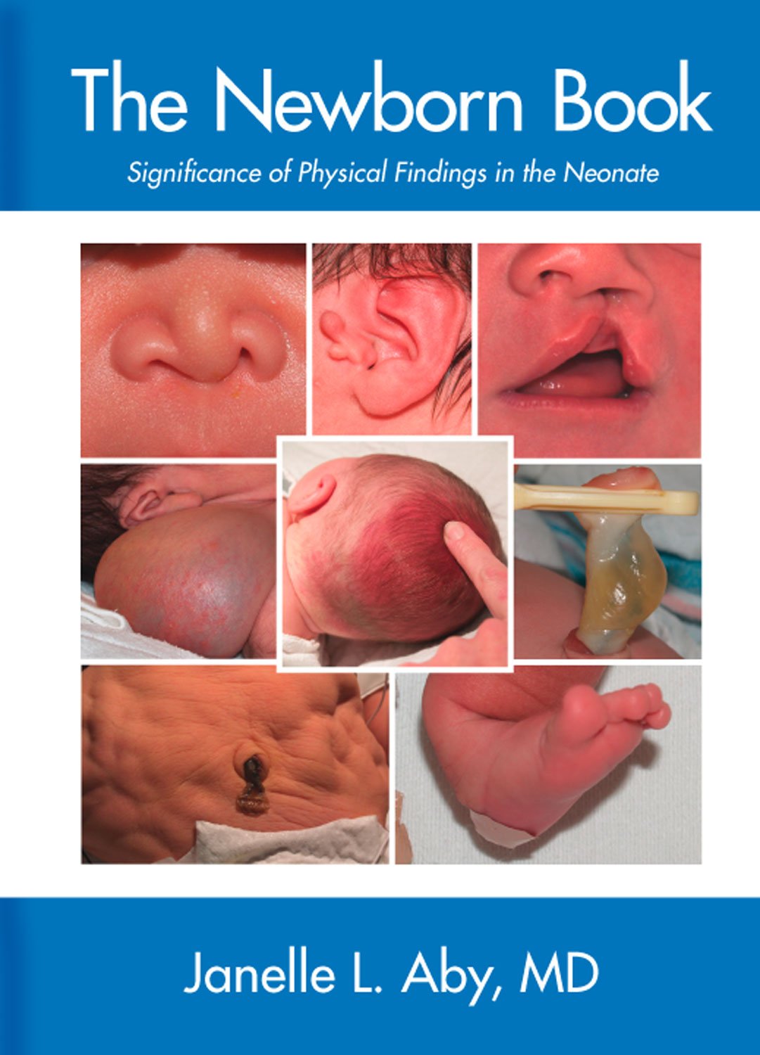 The Newborn Book: Significance of Physical Findings in the Neonate