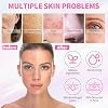 Skin Care Set - 5 Step Skincare with Cleanser, Face Scrub, Clay Mask,Toner & Acne Treatment for Teens and Adults