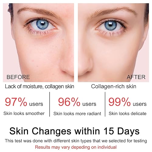 Miniatura 4 de Crema de gelatina de colágeno contiene niacinamida y colágeno hidrolizado liofilizado, elasticidad e hidratación, reduce las líneas finas y la