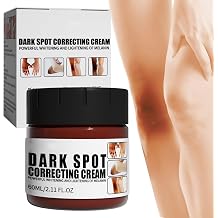 Cream for Correcting Dark Spots Whitening Black Body Skin Skin Whitening Cream for Elbows Whitening Cream for Dark Skin Cream for Removing Black Spots Dark Spot Remover