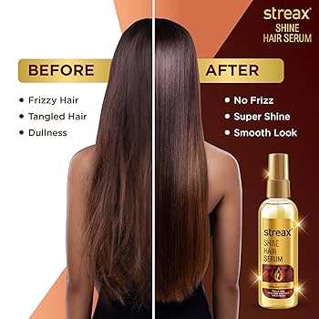 Amazon.com: Streax Vitalized Hair Serum(300 ml) : Beauty