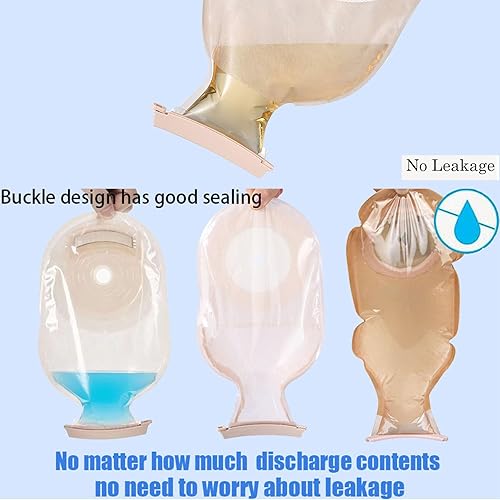 Miniatura 2 de 10 piezas de bolsa de ostomía clip de colostomía suministros de ostomía bolsa drenable abrazadera cola, reutilizable para bolsas de colostomía