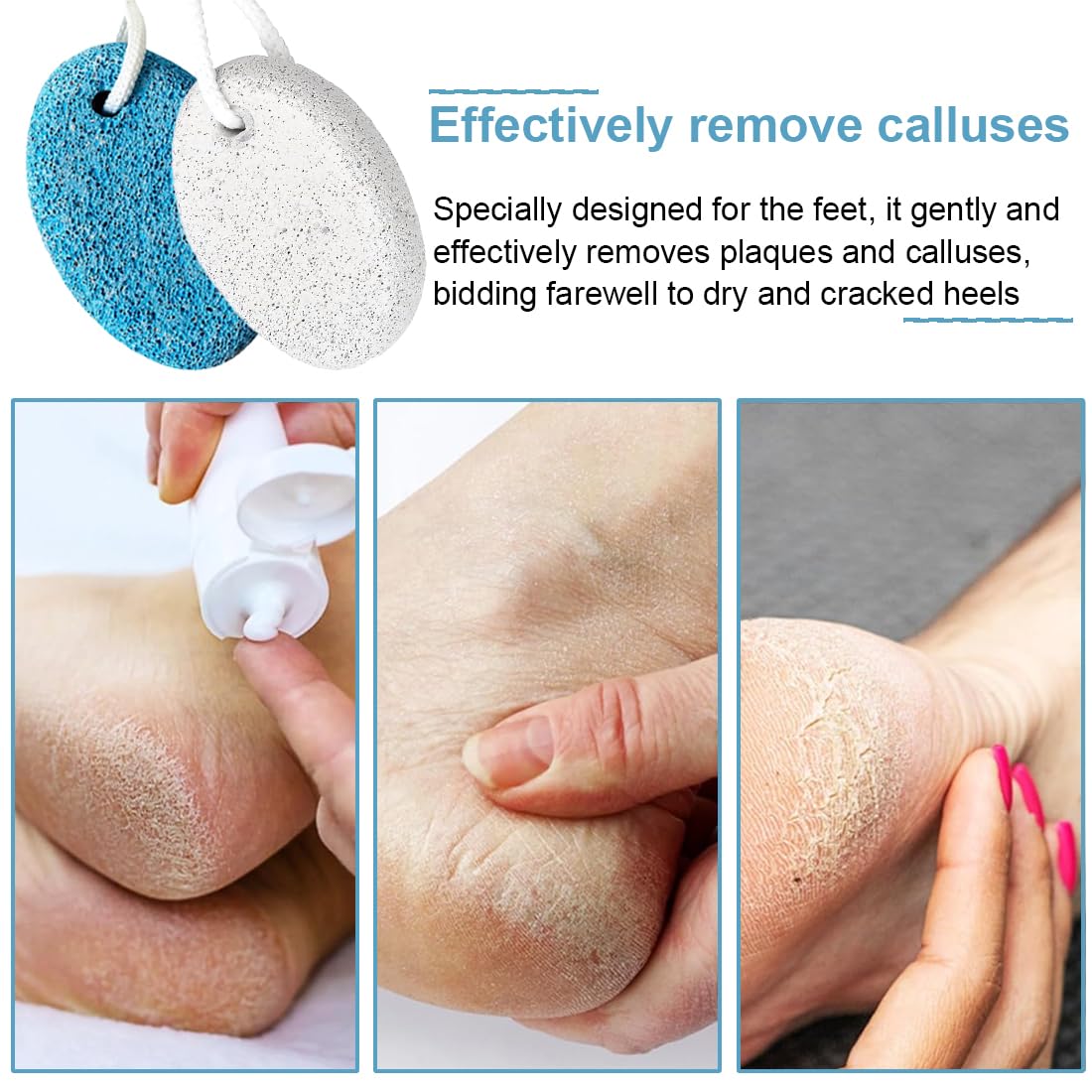 Pietra pomice naturale per piedi 4 PC, Lava Pedicure Tools Rimozione Del Callo Della Pelle Dura, Pietra per Pedicure, Esfoliazione del piede naturale per rimuovere la pelle morta