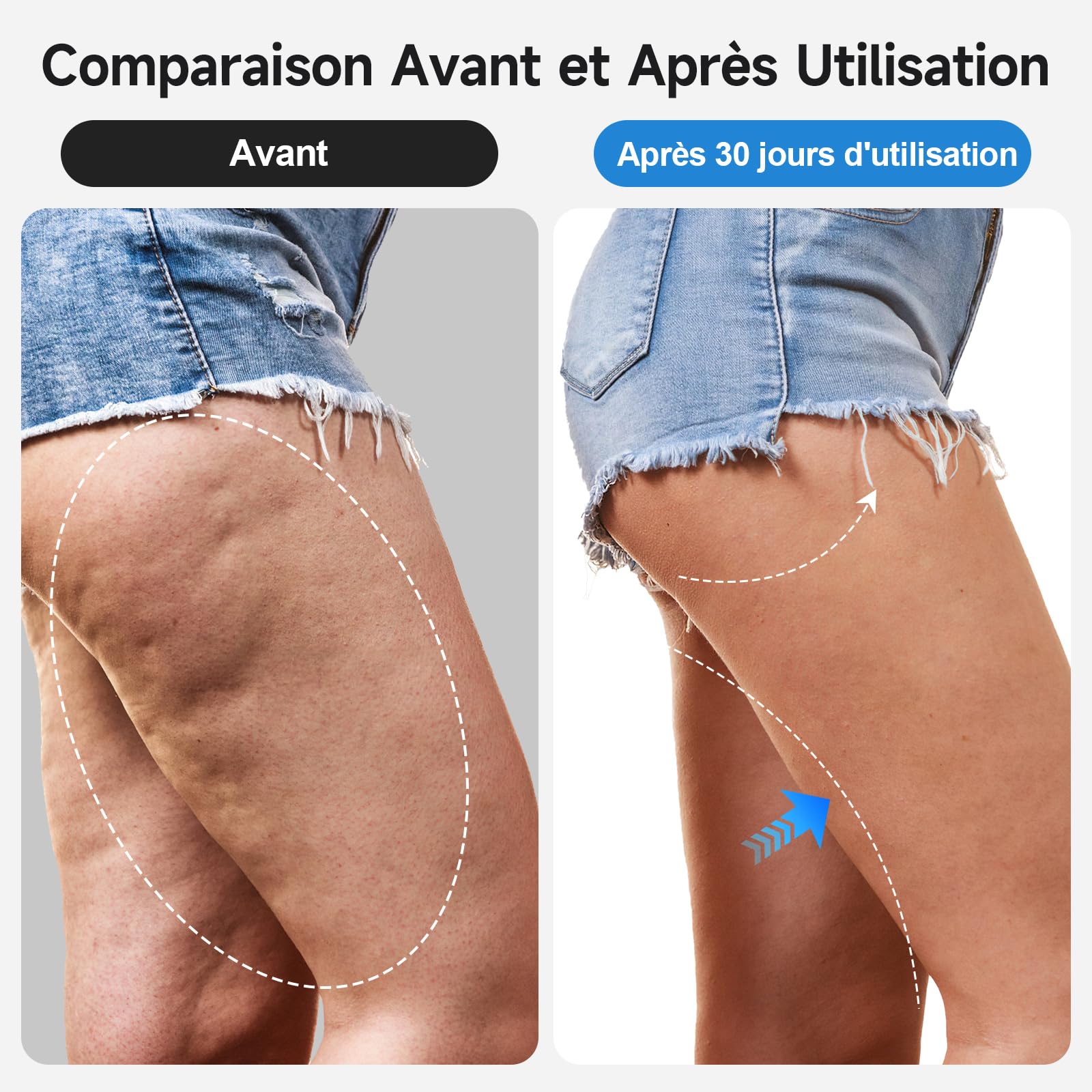 Ventouses 3 en 1 anti-cellulite | Ventouses, EMS, lumière rouge. Ventre/jambes/fessiers, 3–5 min/jour, peau ferme
