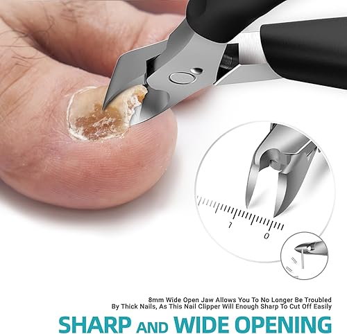 Miniatura 9 de RONAVO Cortaúñas  Tratamiento de uñas encarnadas y cortaúñas para uñas gruesas  Cortauñas profesional resistente para hombres y ancianos, tijeras