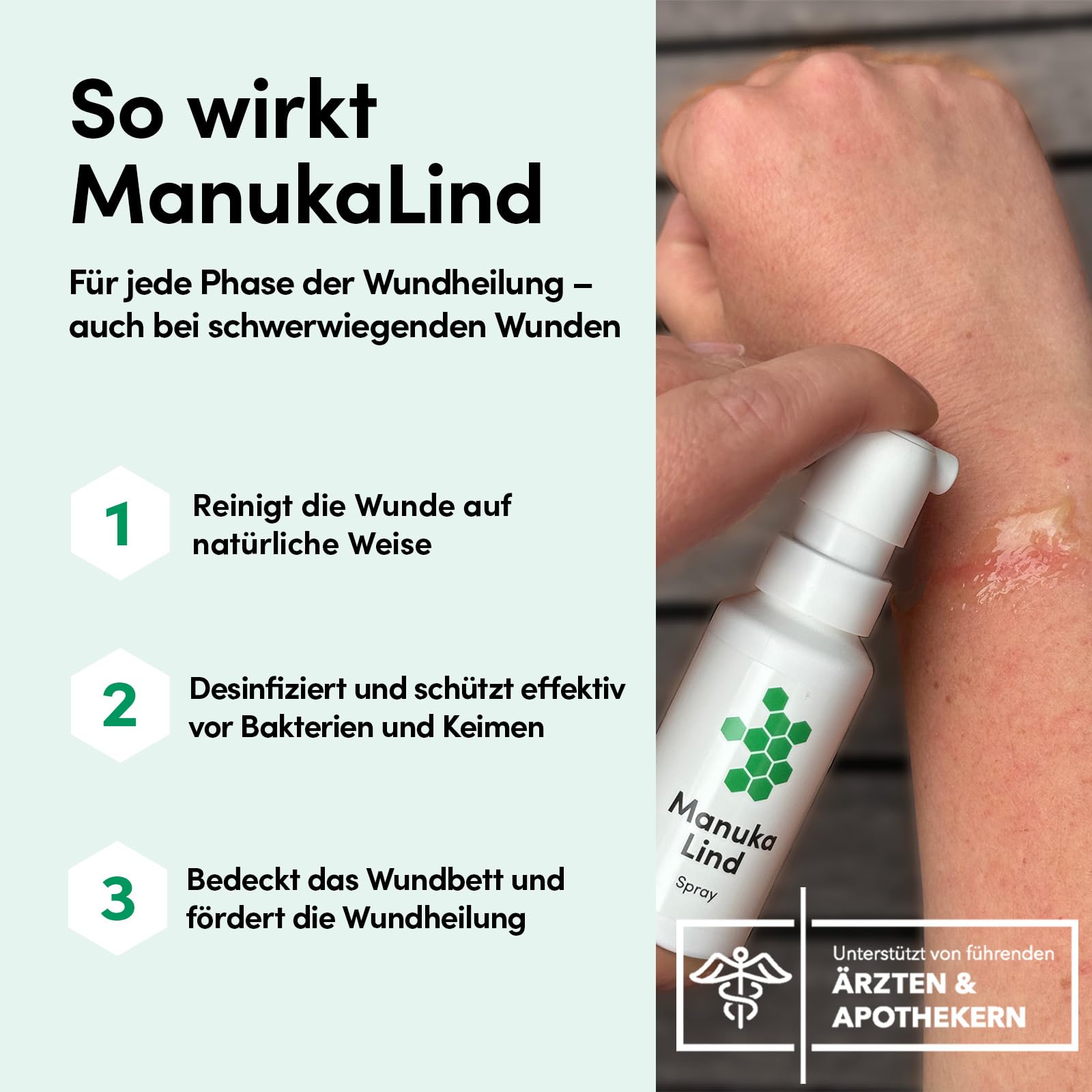 Wundheilspray 2x30ml - mit Manuka-Honig MGO 514+