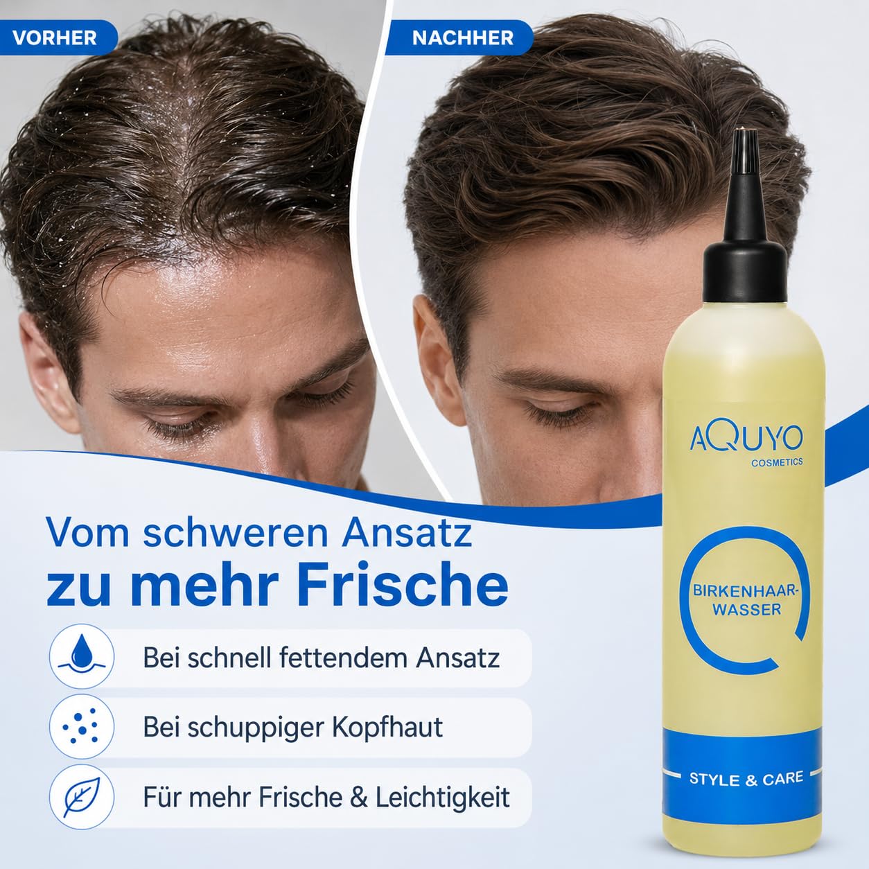 Birkenhaarwasser für trockene Haare und empfindliche Kopfhaut (3er Pack - 3x 200ml) | Birkenwasser gegen Schuppen und fettige Haare | Haarwasser zur Kopfhautpflege