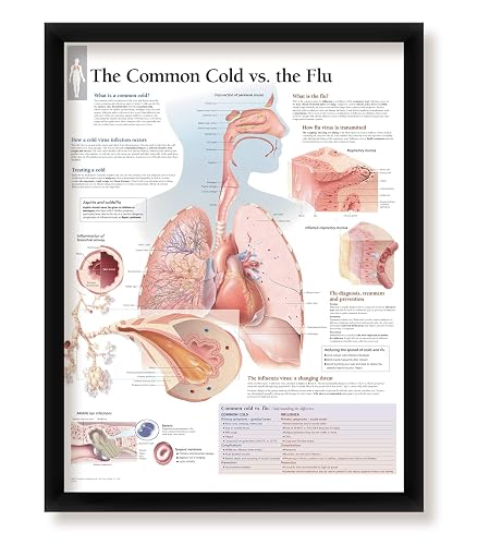 The Common Cold vs. The Flu Framed Medical Educational Informational