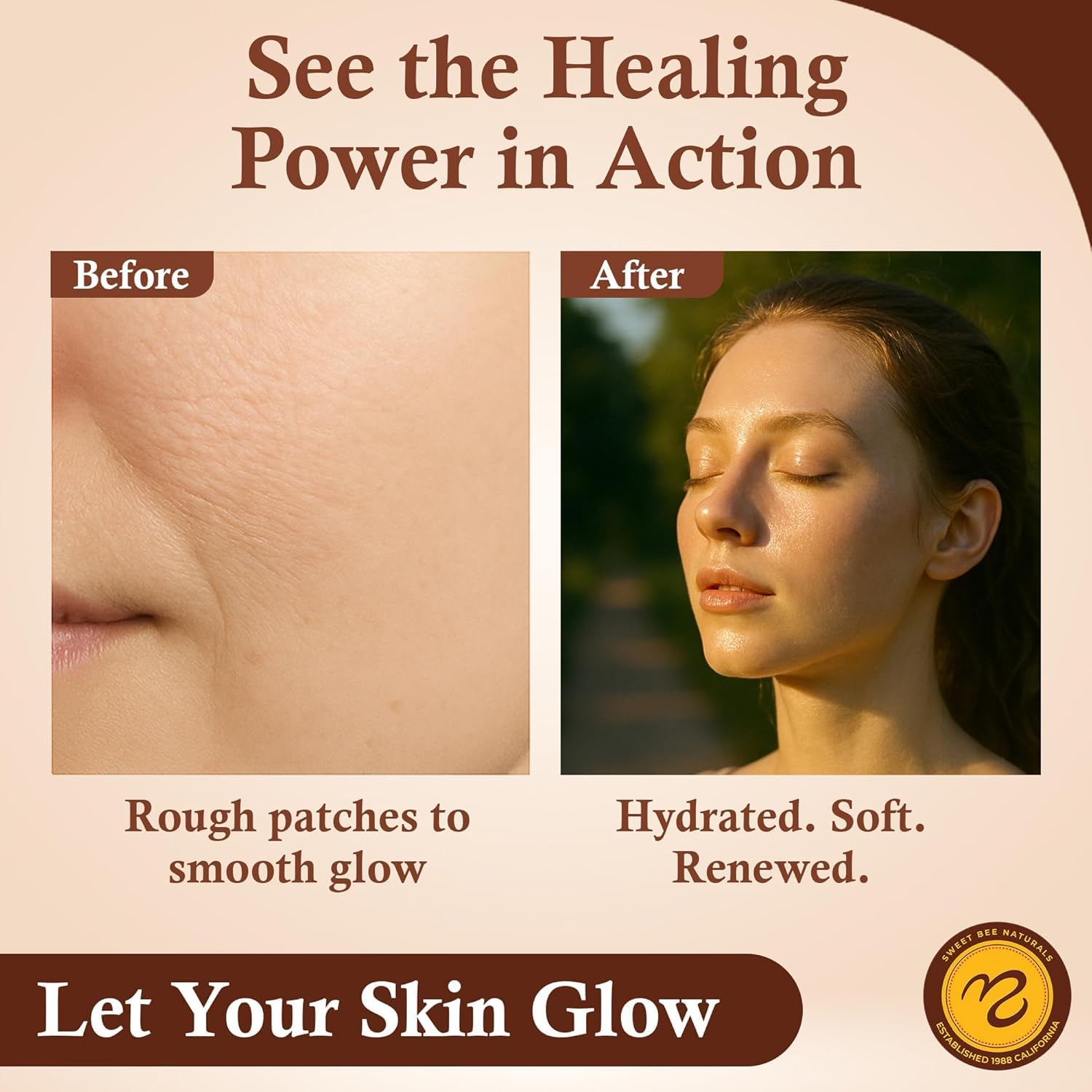 Sweet Bee Magic All In One Healing Organic Balm - Natural Skin Healing Cream, Beeswax Balm for Dry Skin, Face & Body Moisturizer - All Natural Aid - 1 Jar (4oz) - Image 7