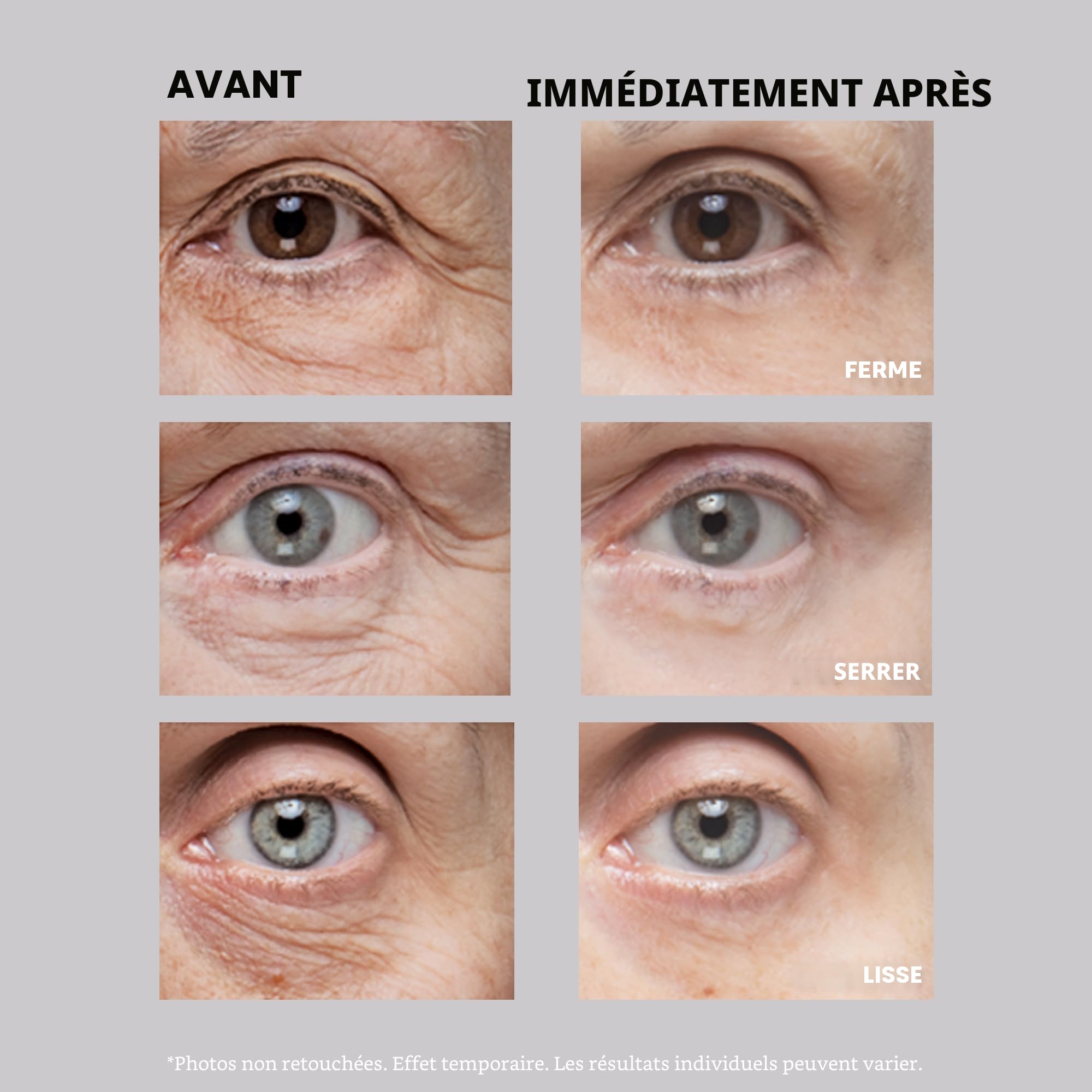 Peter Thomas Roth - Instant FIRMx Eye - Soin contour de l'œil raffermissant - 30mL