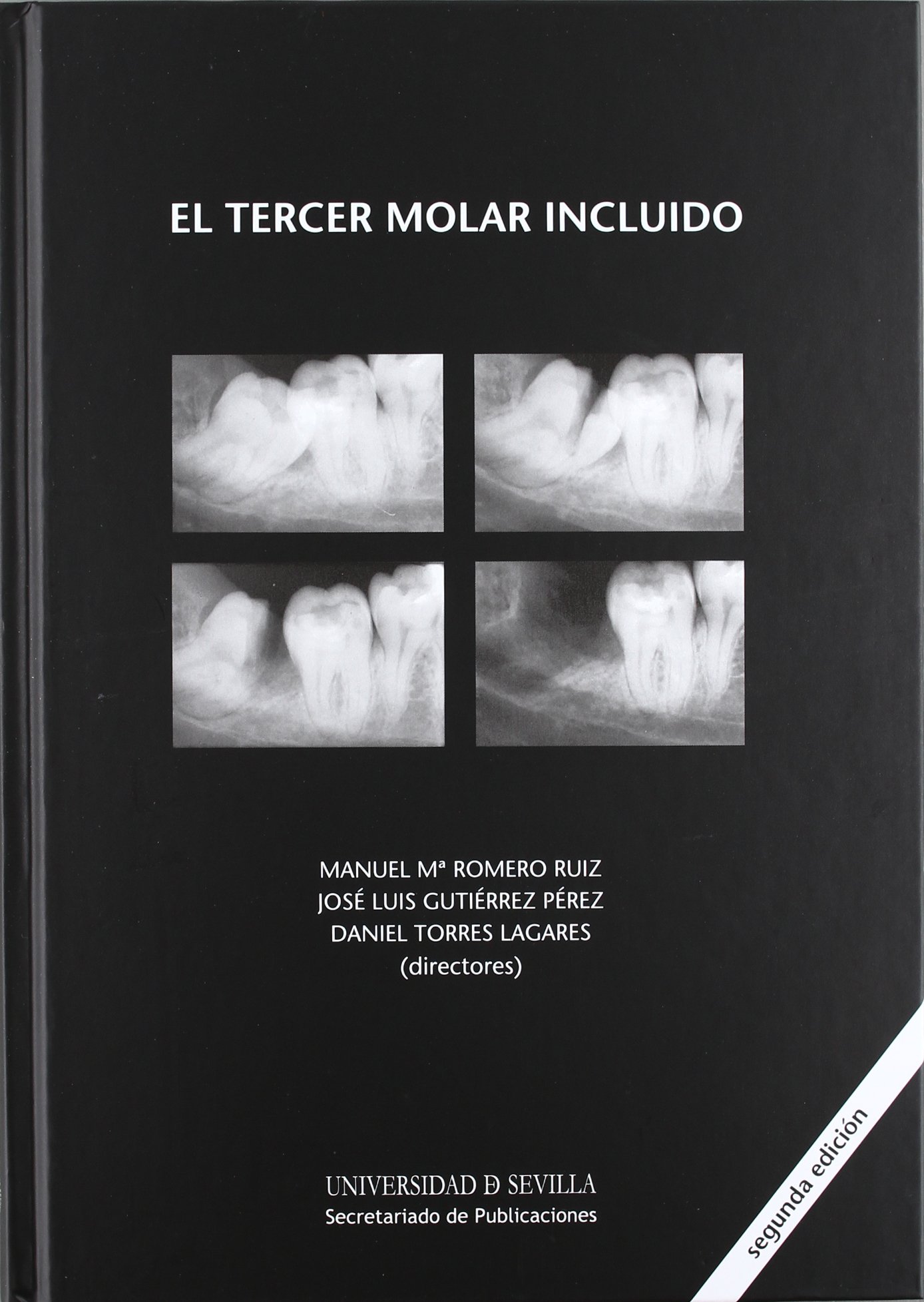El tercer molar incluido: 83 (Ciencias de la Salud)