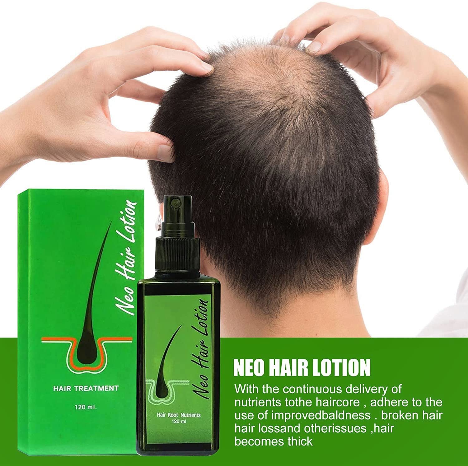 Hair Growth Serum Hair Lotion ,Hair Loss Treatments, Aids against Hair