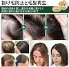OUHOE Ginger Hair Growth Soap Shampoo, Ginger Extract Hair Loss Promotion Shampoo, Ginger Hair Dense Shampoo Soap Anti-Shampoo, Ginger Revitaginger Hair Boost Shampoo Bar 1 Piece