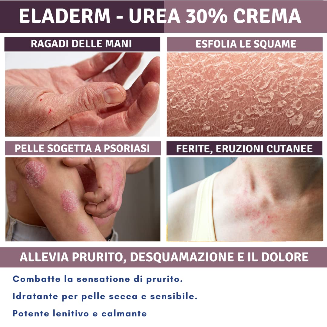 Crema Urea 30%, 100ml, Eczemi, Cheratosi, Psoriasi, Eruzioni Cutanee, Dermatite, Prurito, Piedi Secchi, Talloni Screpolati, Calli, Duroni | Idratazione Profonda | Vitamin A, E, Burro di karitè
