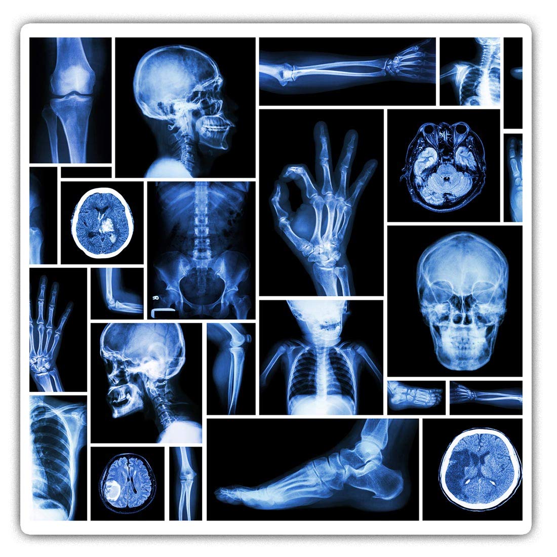 Destination Vinyl Ltd Multi Square Stickers (Set Of 2) 10Cm - X-Ray Collection Hospital Doctor Laptop Tablet Luggage Scrapbook #21375