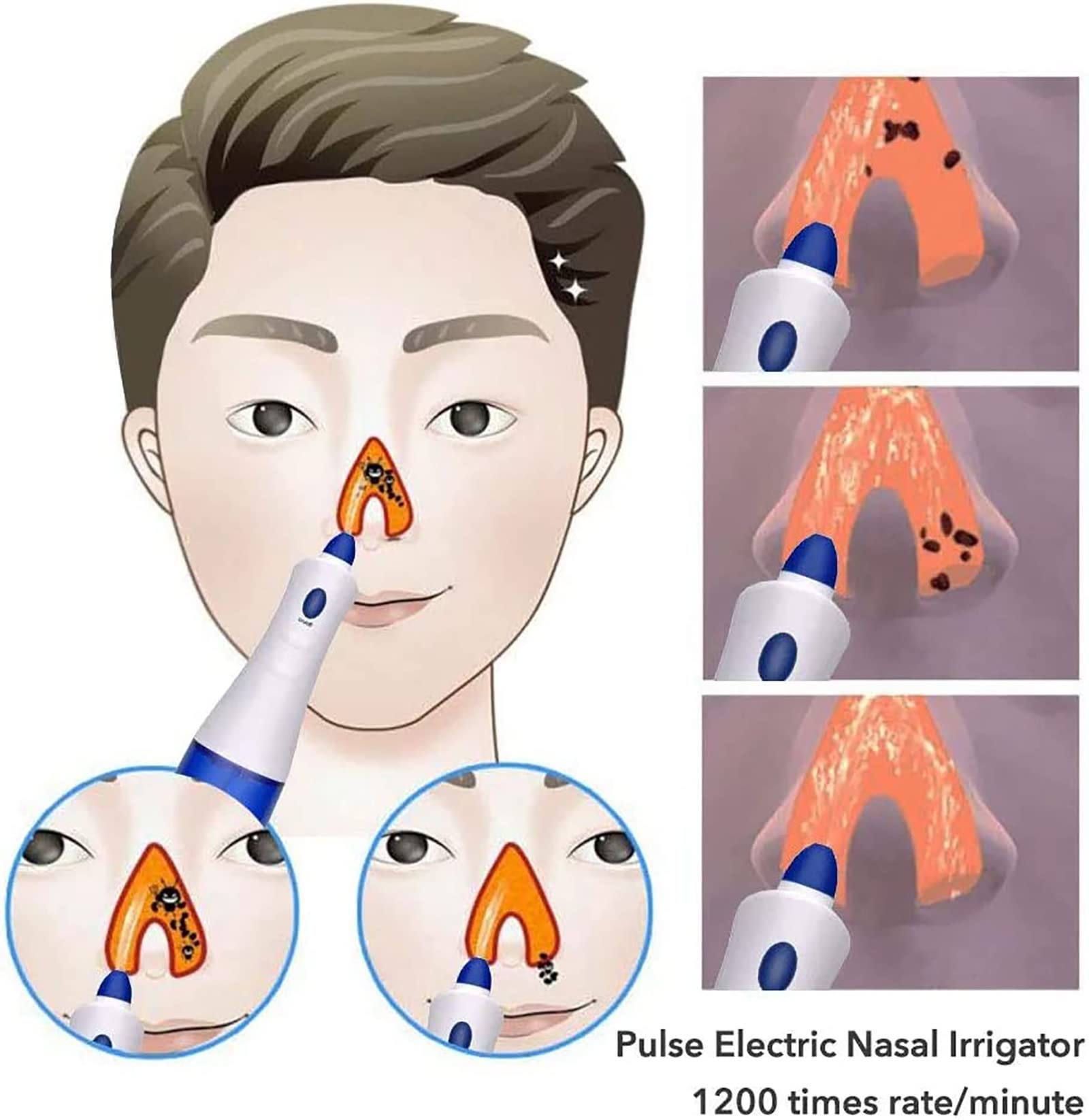 Système d'irrigation des Sinus nasaux, Nettoyeur de Nez électrique pour bébé avec Deux becs, aspirateur de Nez Anti-refoulement pour Adultes et Enfants