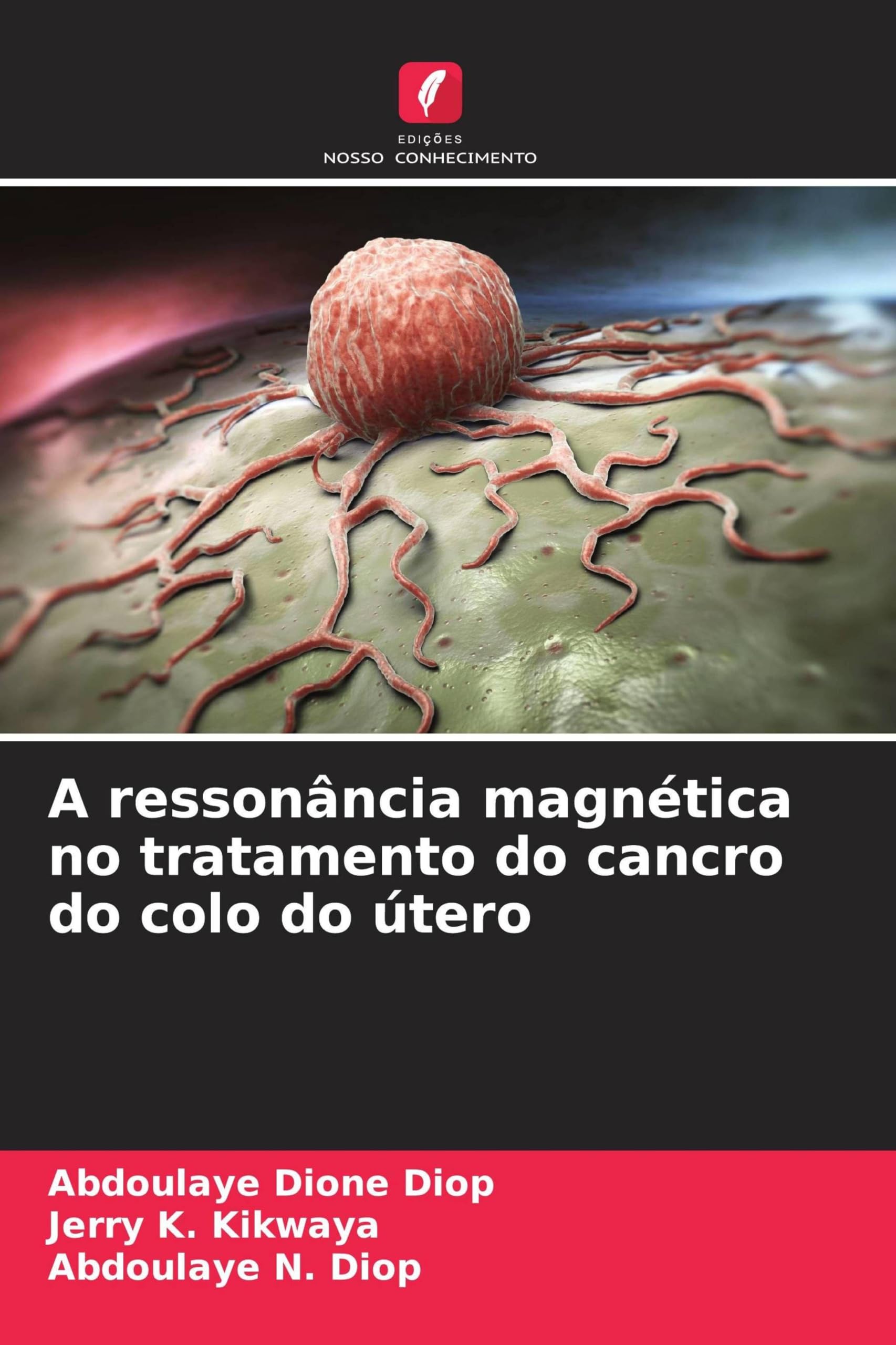 A ressonância magnética no tratamento do cancro do colo do útero
