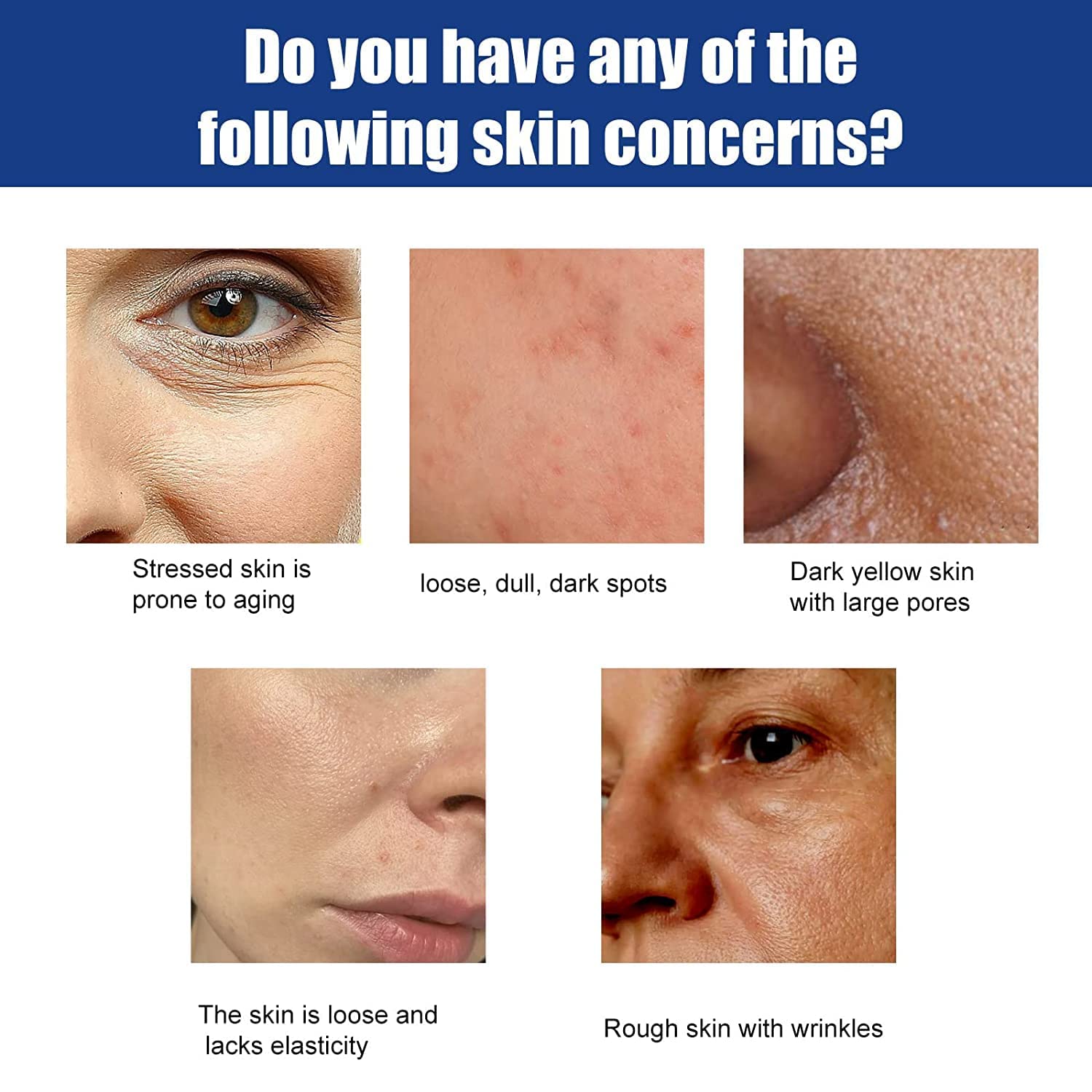 lipo c peptide before and after Peptides for Weight Loss Tampa Bay Mots-c peptide,Collagen Blue Copper Peptide