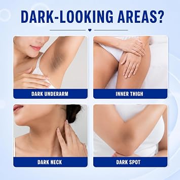 Skin Whitening Cream, Skin Bleaching Cream for Underarms Inner Thighs Bikini Line Knees Elbows, Deep Nourishing Brightening Body Moisturiser for Dark Areas, Even Skin Tone, Soft Smooth Skin, 100g