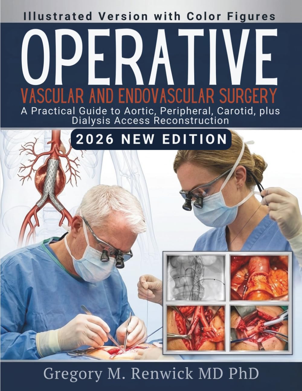 Operative Vascular and Endovascular Surgery: A Practical Guide to Aortic, Peripheral, Carotid, plus Dialysis Access Reconstruction