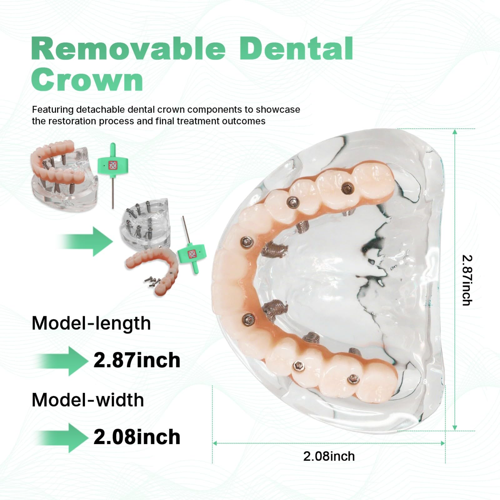 Modelo de implante dental de doble arco. Sistema de entrenamiento de sobredentadura All-On-6 y All-On-4. Bases transparentes para maxilar y mandíbula