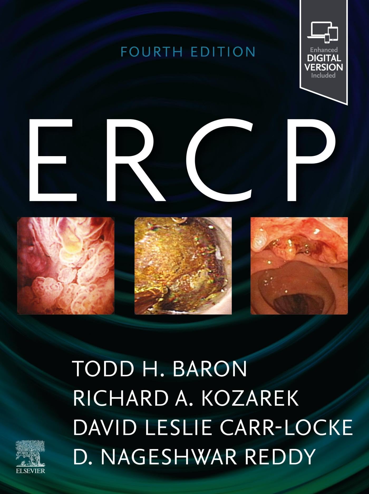 ERCP E-Book (English Edition)
