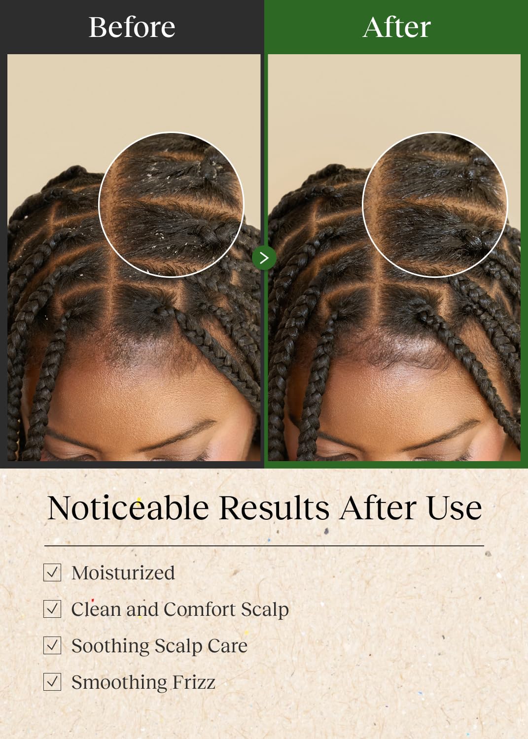 Braid Rev Scalp Cleansing Toner & Sleeping Oil Balm Set, Scalp Treatment for Itchy Hair, Nourishing for Dry Scalp, Moisturizing Braid, Detoxify