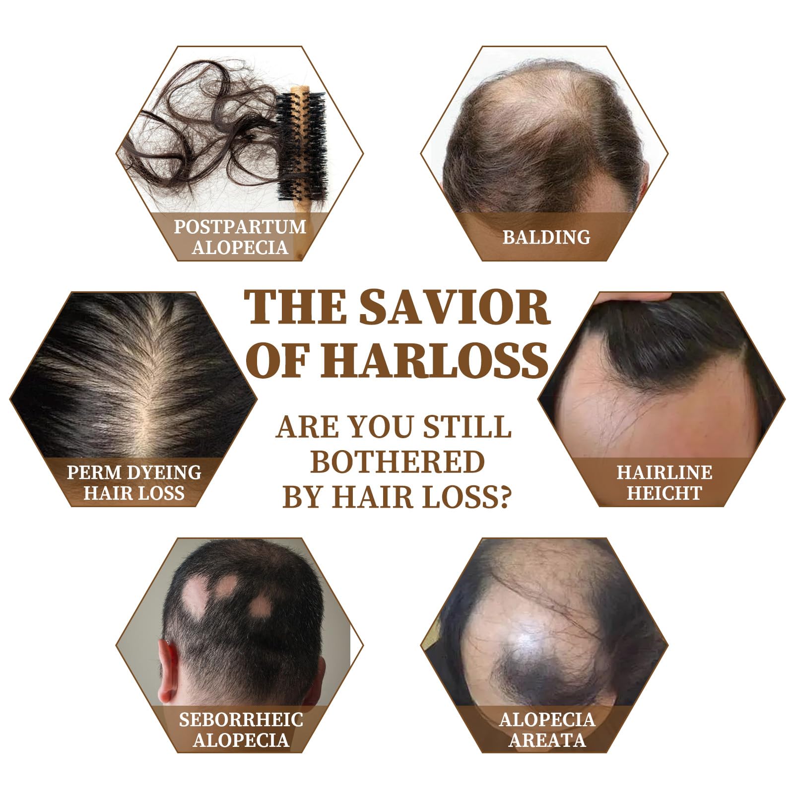 2PCS Rice Water for Hair Growth Rice Water Hair Serum for Dry Damaged Hair Rice Hair Growth Oil for Thinning Hair and Hair Loss,Deeply Nourishes Hair Scalp Growth Serum Strengthening Anti-Hair Loss - Image 4