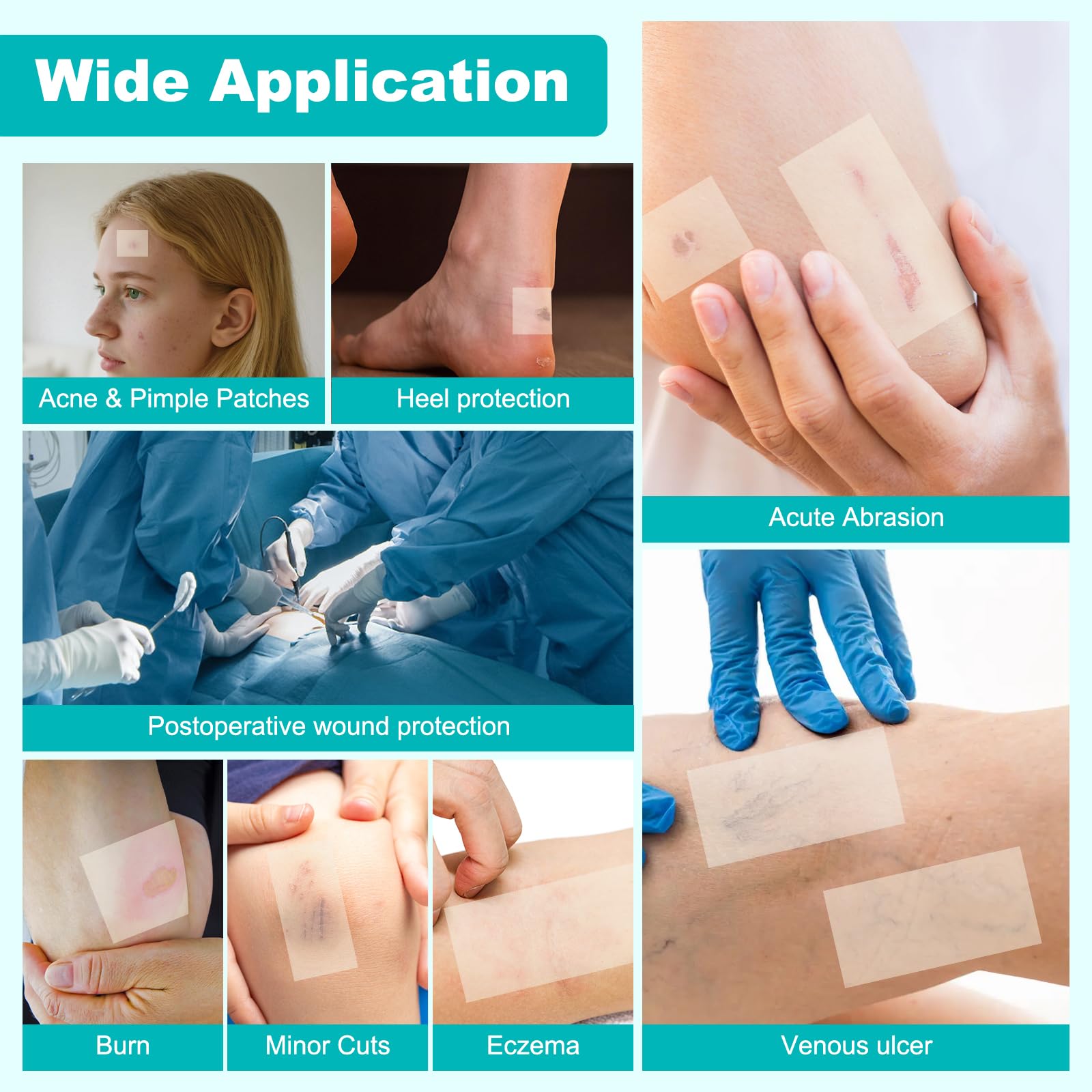 Hydrocolloid Bandages - Cut to Size Wound Care -5 Hydrocolloid Bandages - Cut to Size Wound Care -5