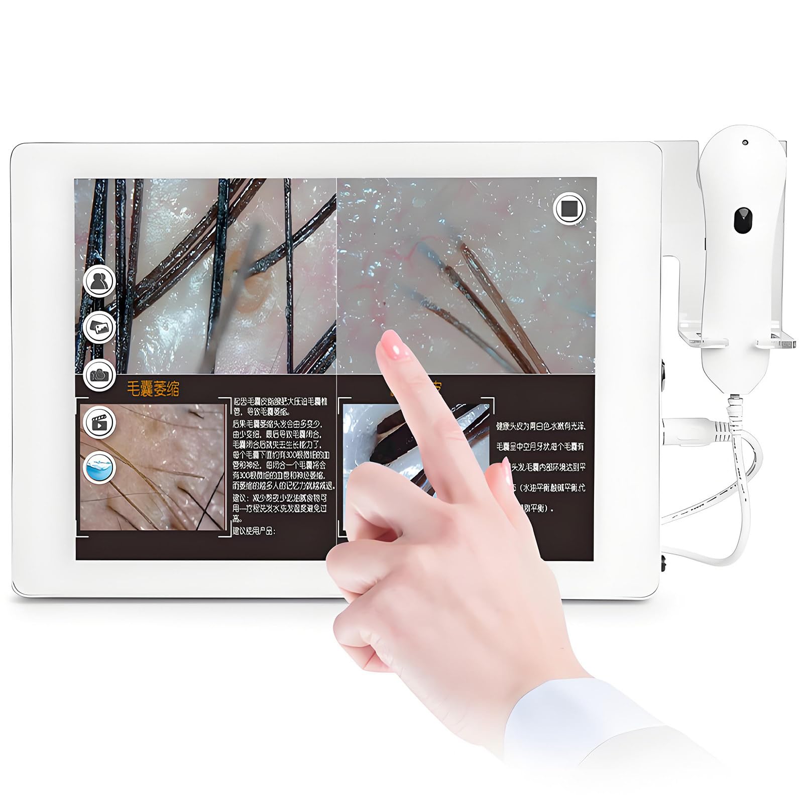 Haut Haar Analysegerät,Kopfhautanalysegerät mit 15 Zoll HD LCD Bildschirm für Haut Und Haaranalyse,32g,Dualobjektiv,Analysegerät Multifunktionaler Digitaler Hautpflege-Analysegerät