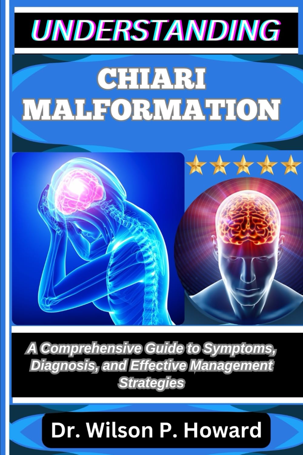 UNDERSTANDING CHIARI MALFORMATION: A Comprehensive Guide to Symptoms, Diagnosis, and Effective Management Strategies