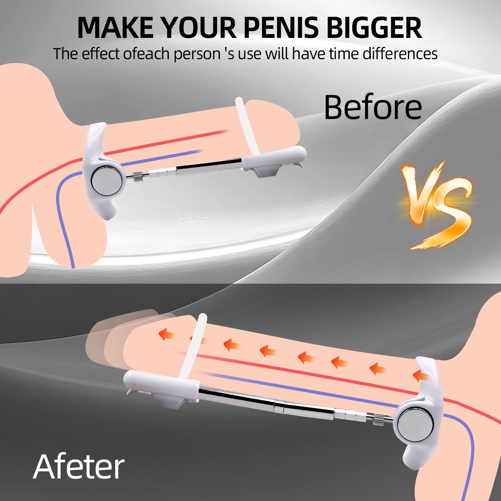 Penis Extender Stretcher Kit, Penis Pump Sex Toys For Men, Penis - View #12