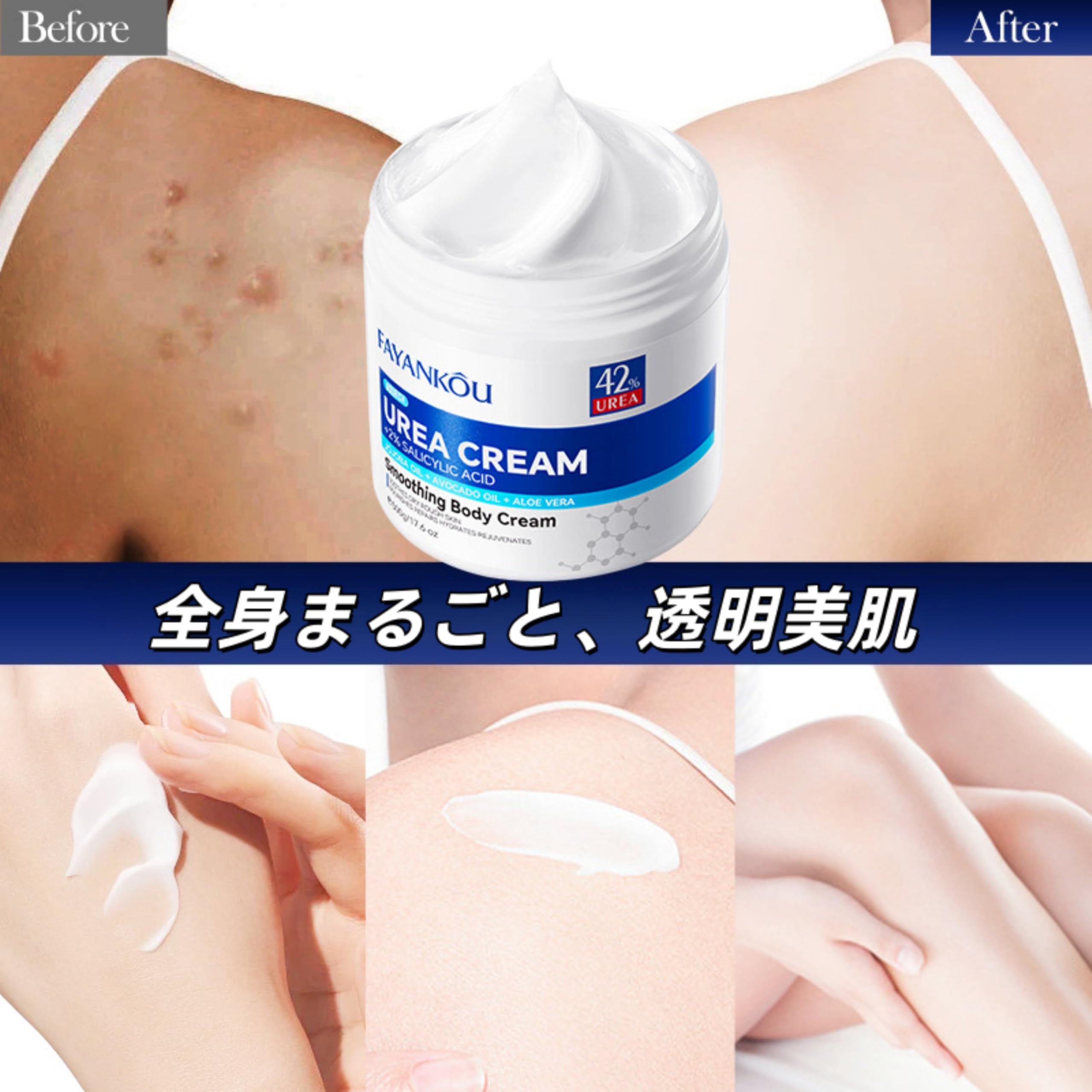 Amazon | 尿素 ボディクリーム 大容量 500g [ 尿素 サリチル酸 配合