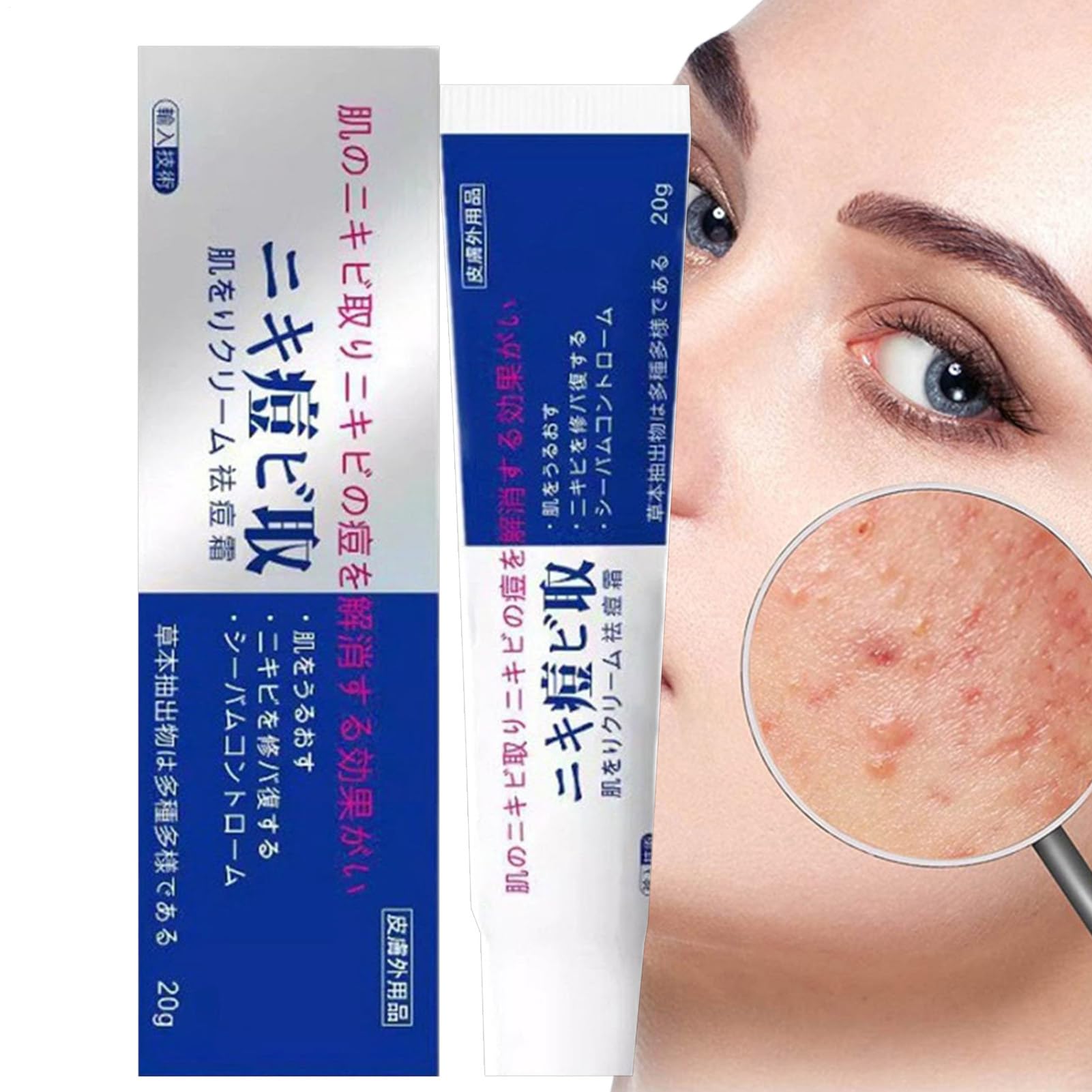 Pair Acnes Cream, Japanese Acnes Cream, 20g Dark Spots Remove, Blemish Repair for Pimples Prone Skin
