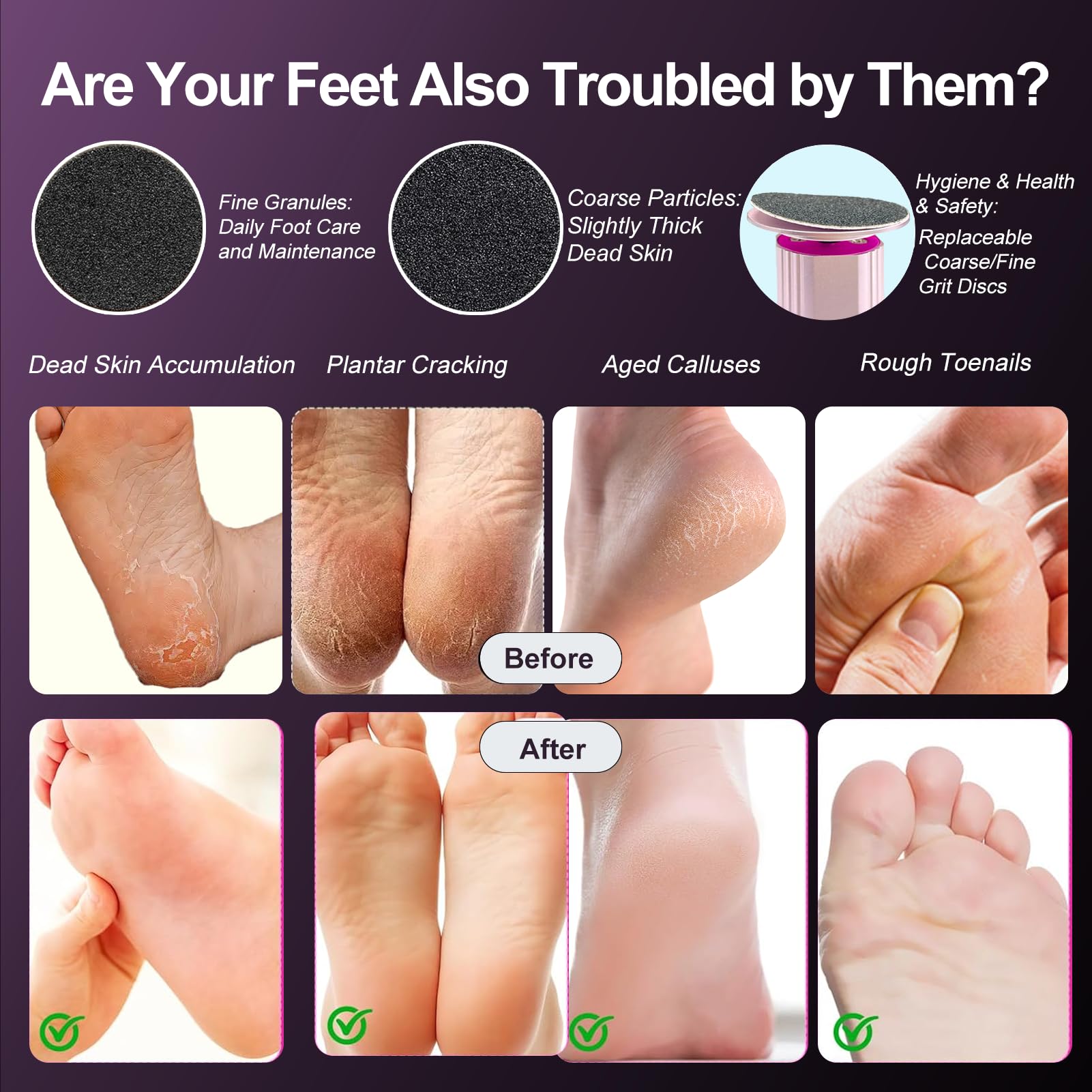 Pedicure Elettrico Professionale Pied, 1 Pezzo Raspa Piedi Professionale Elettrico con 9 velocità, Lima per Piedi E Talloni, Rimuovi Calli Piedi Fresa Lima Talloni Cura Pulizia Calli