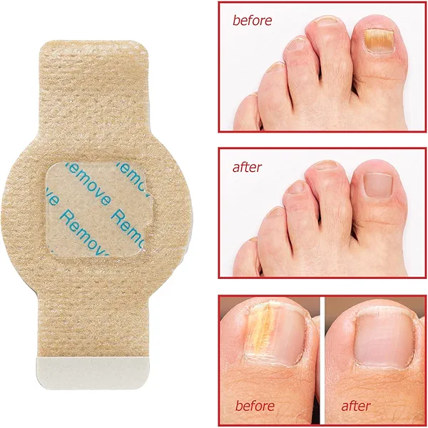 Nail Patches 21 Pcs, Toenail Treatment Extra Strength, 8-Hour Overnight Nail Treatment for Damaged, Discolored and Thickened Nails, Effortless Hydrogel Nail Care for Women and Men