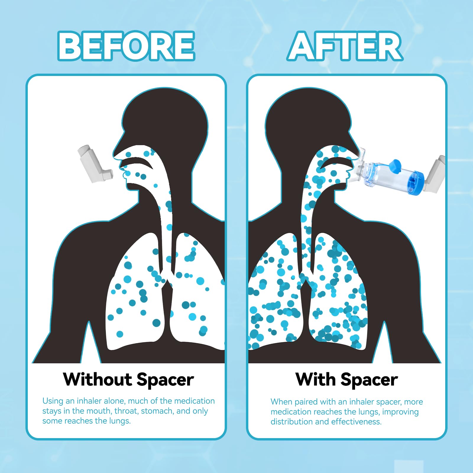 Inhaler Spacer for Kids Nessi OTC Spacer, FSA HSA Eligible (Blue/KIDS)