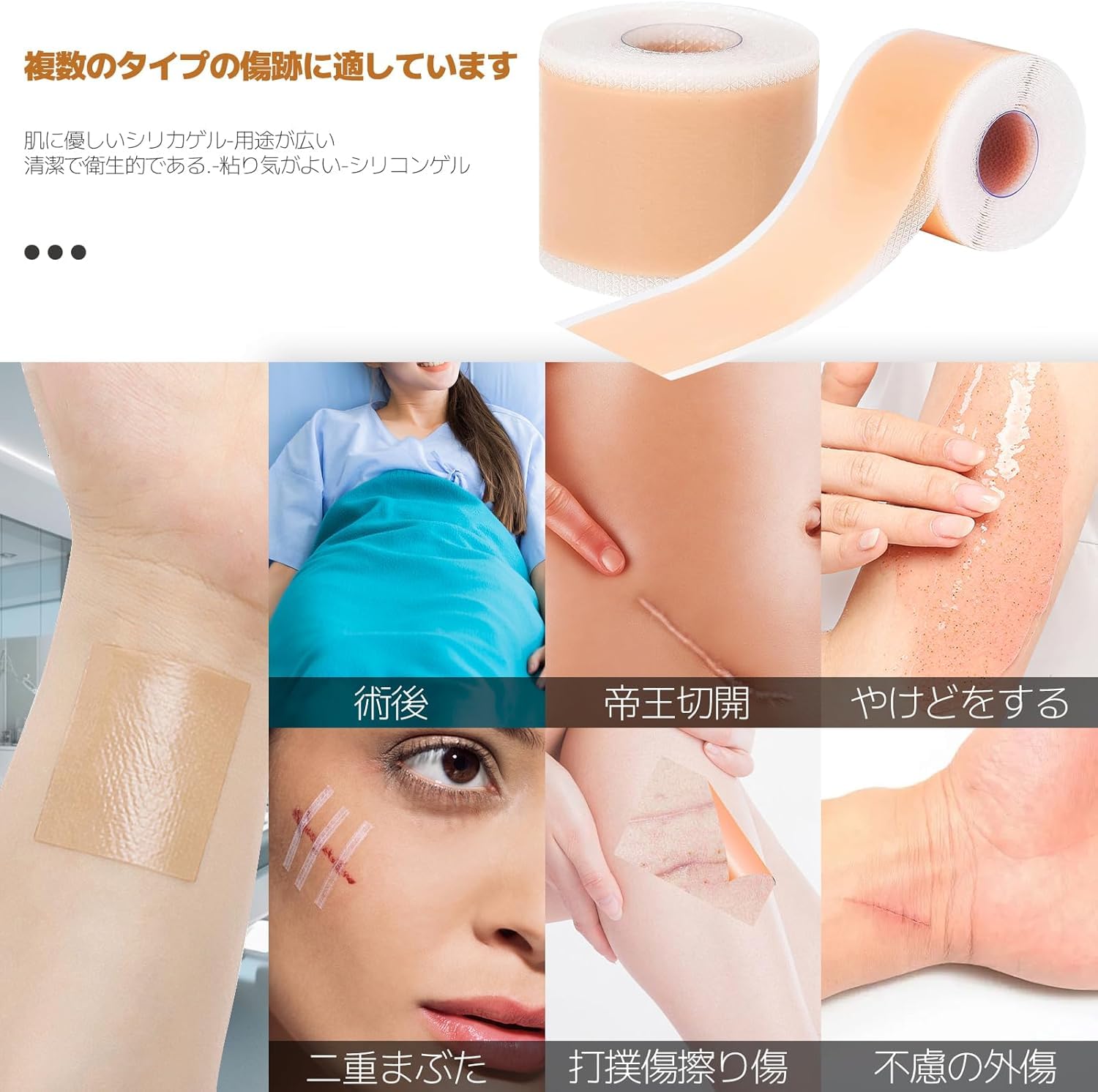 Amazon.co.jp: zhihu 傷跡ケアテープ ケロイド テープ 4cm×300cm 傷