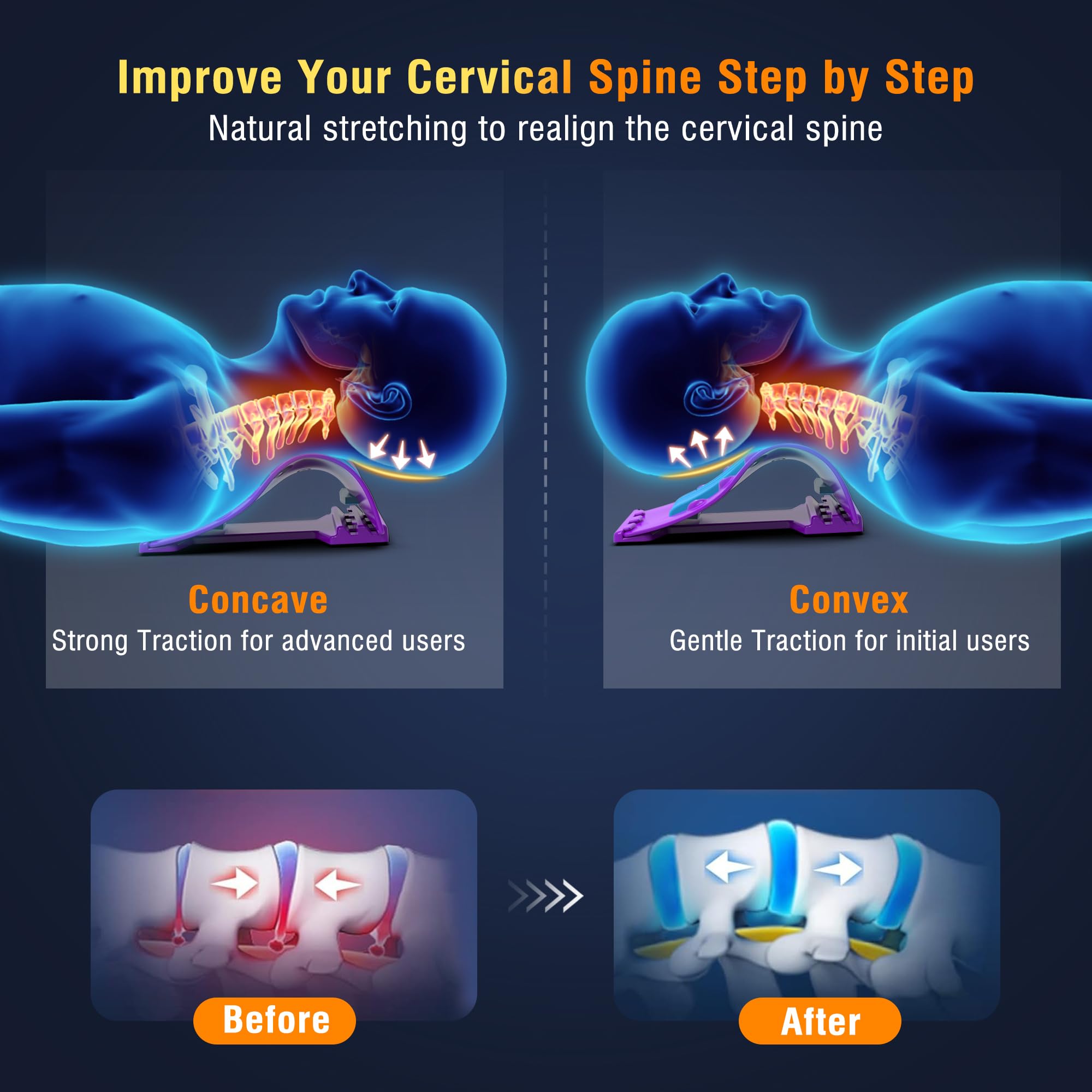 Estirador de cuello, dispositivo de tracción cervical para aliviar el dolor de cuello, Sretcher de cuello para dolor de cuello, dispositivo de alivio instantáneo del dolor de cuello, soporte de cuello
