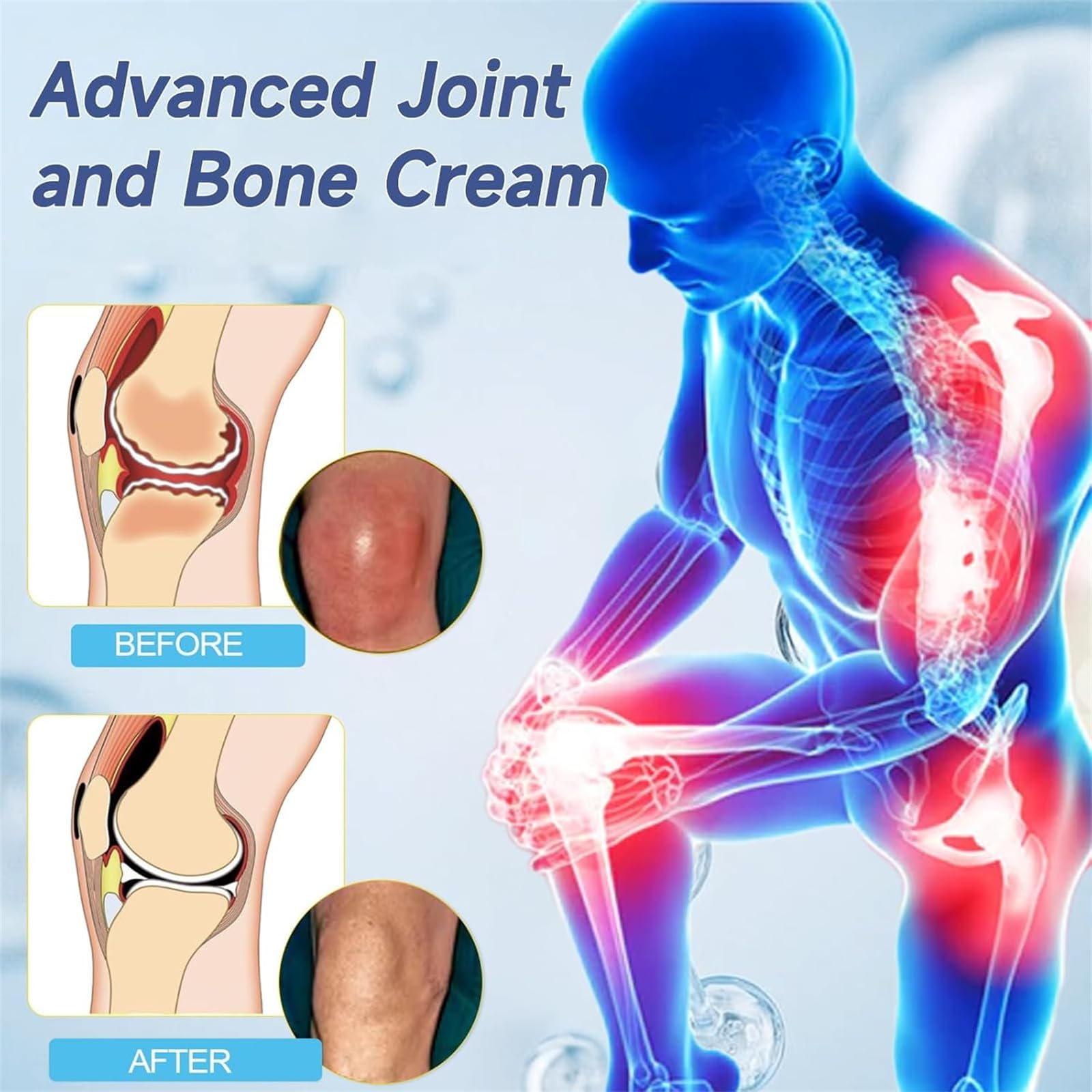 Krem Arthroheal z kwasem hialuronowym do naprawy stawów, krem Arthroheal łagodzący ból, krem z kwasem hialuronowym do stawów i kości, krem terapeutyczny do stawów i kości, na plecy, szyję, dłonie