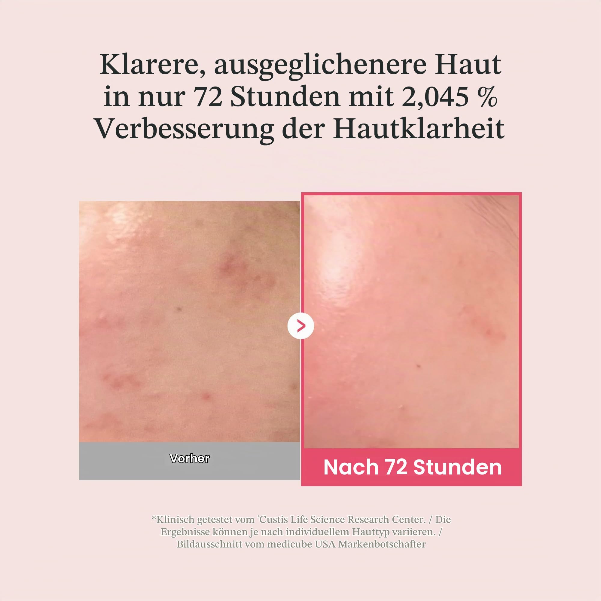 TXA Niacinamide Serum 15