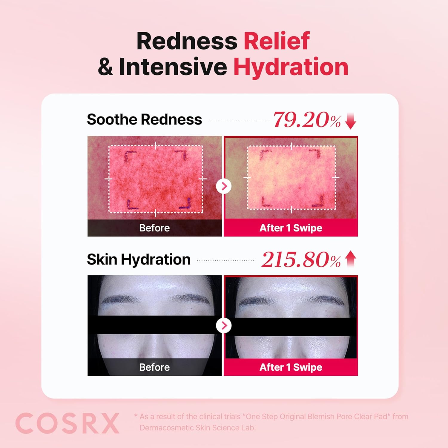 COSRX OneStep Original Blemish Pore Clear Pad, 100 Pads, Dual-Sided Facial Pad for Exfoliation, Pore Care & Hydration with BHA, PHA & Zinc PCA & 5 Hyaluronic Acids, Korean Skin Care