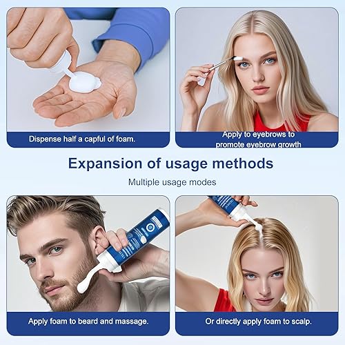 Miniatura 6 de Espuma tópica de minoxidil al 5 %, minoxidil para hombres y mujeres, impregnada con biotina, tratamiento para el crecimiento del cabello, soporta