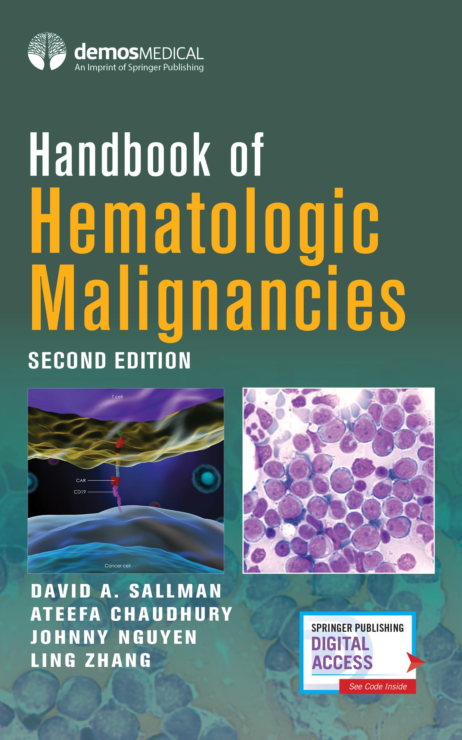 Handbook of Hematologic Malignancies Paperback – Import, 30 December 2020