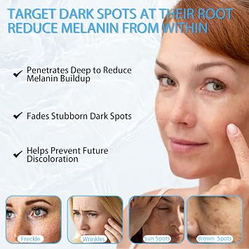 Discoloration Correcting Serum - Glycolic Acid & Kojic Acid - Defense & Correcting Skin 30ml