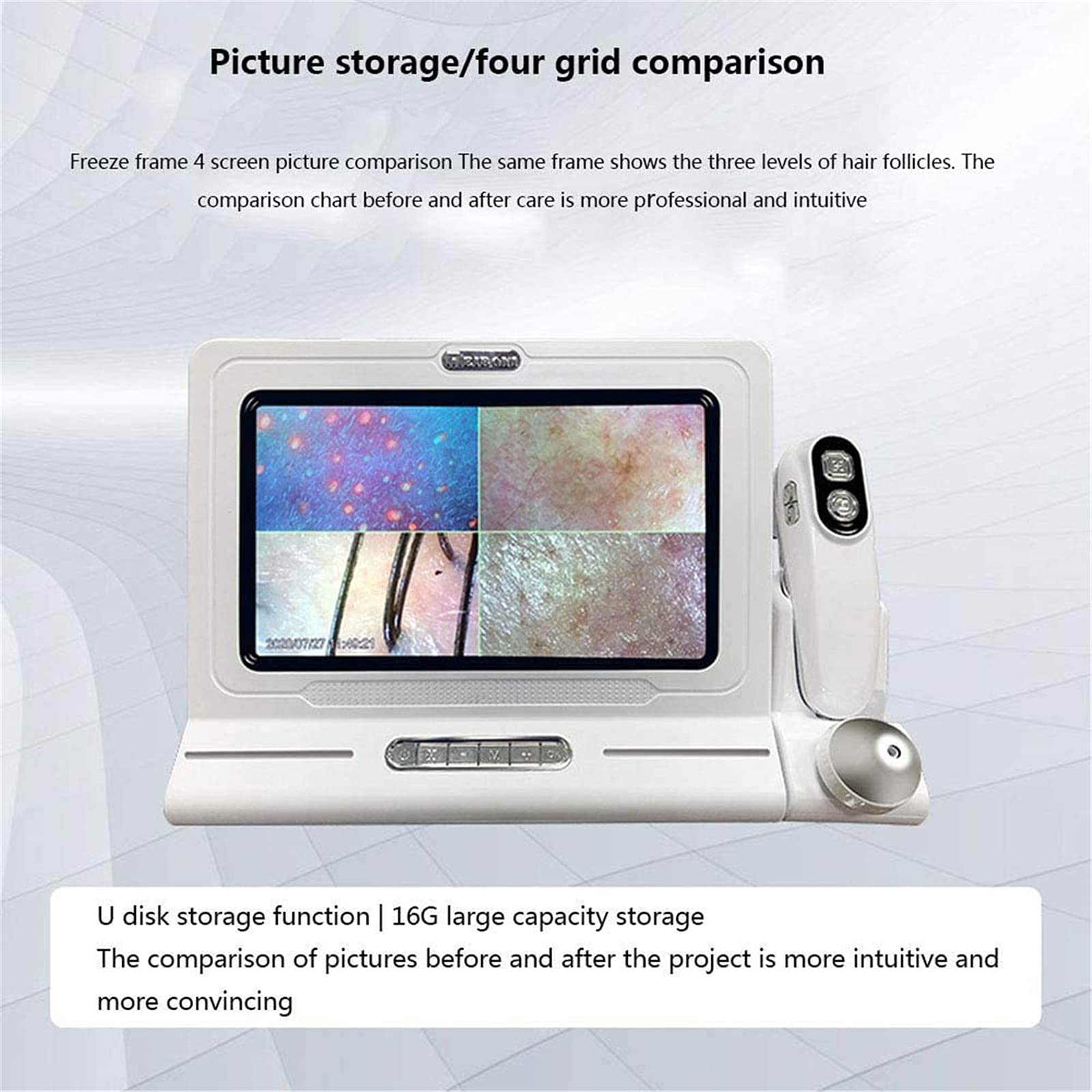 Amazon.co.jp: 50X / 200X皮膚診断ヘアアナライザーマシン、11インチ