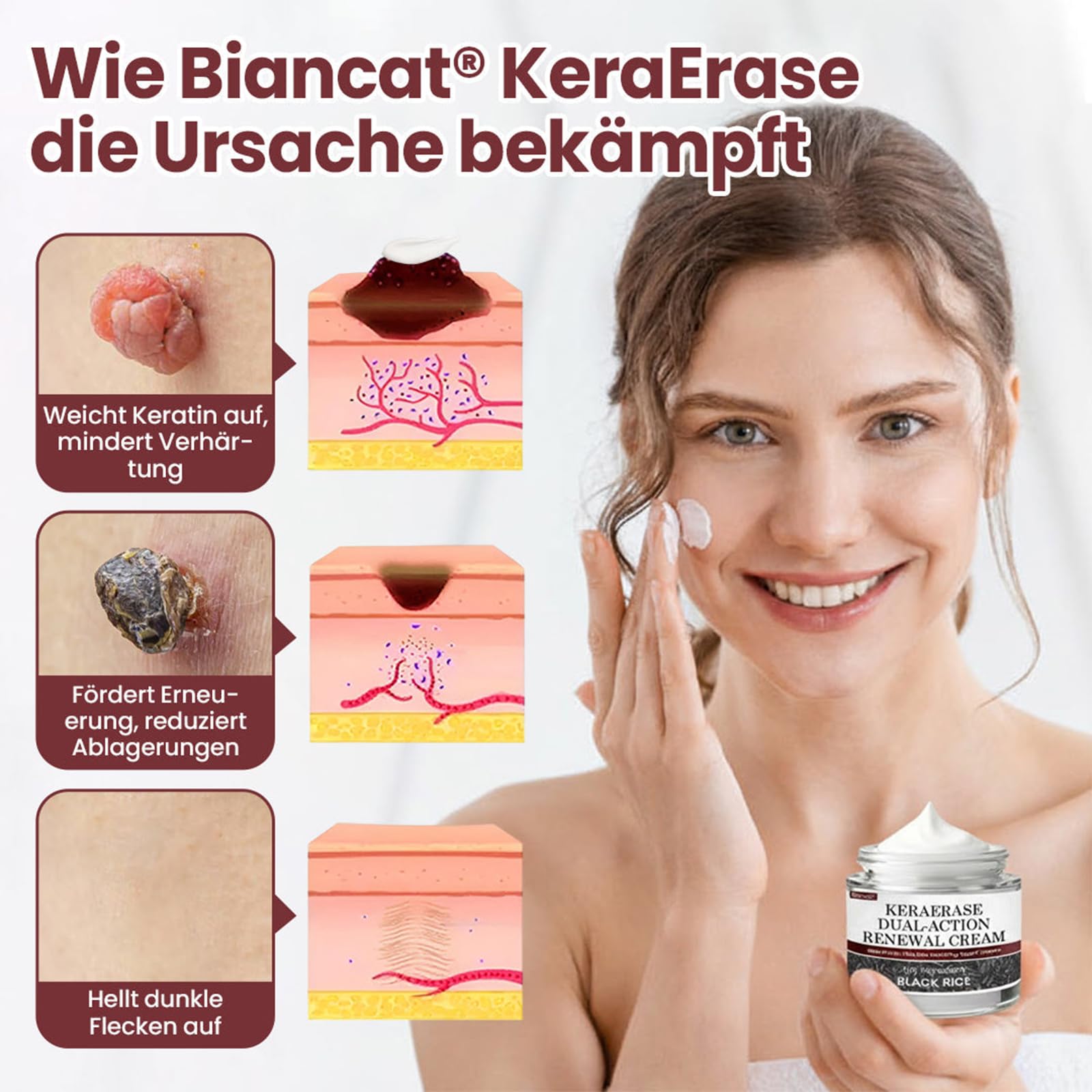 Biancat KeraErase Dual-Action Erneuerungscreme, Biancat Warzen und Hautwucherungen Entfernen Creme, Natürlich KeraErase Hautreparaturcreme, für Aller Hauttypen (1 Stück)