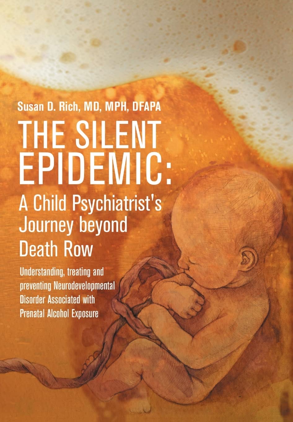 The Silent Epidemic: A Child Psychiatrist's Journey beyond Death Row: Understanding, Treating, and Preventing Neurodevelopmental Disorder Associated with Prenatal Alcohol Exposure